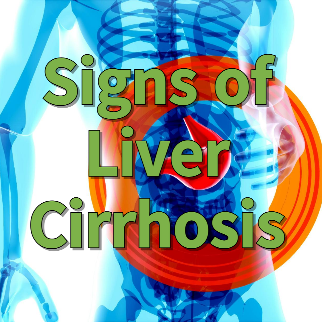 Signs of Liver Cirrhosis